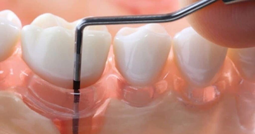 What are the reasons and risk factors for periodontal disease?